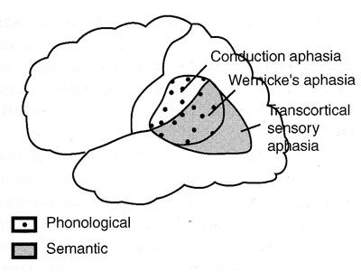 Фонология и семантика в постериорных речевых зонах