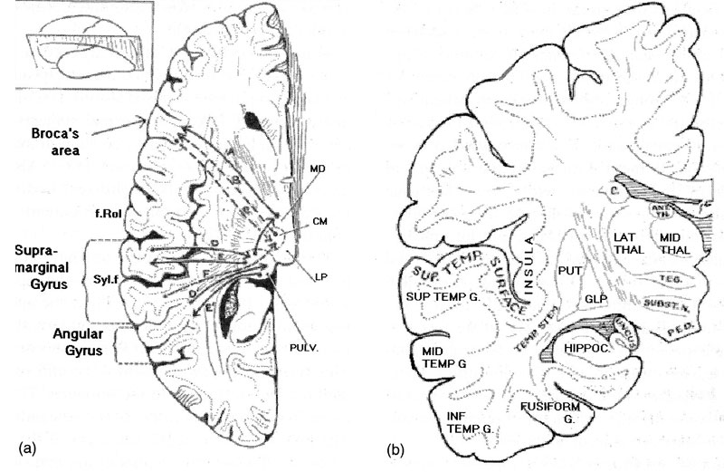 Таламус и языковые зоны